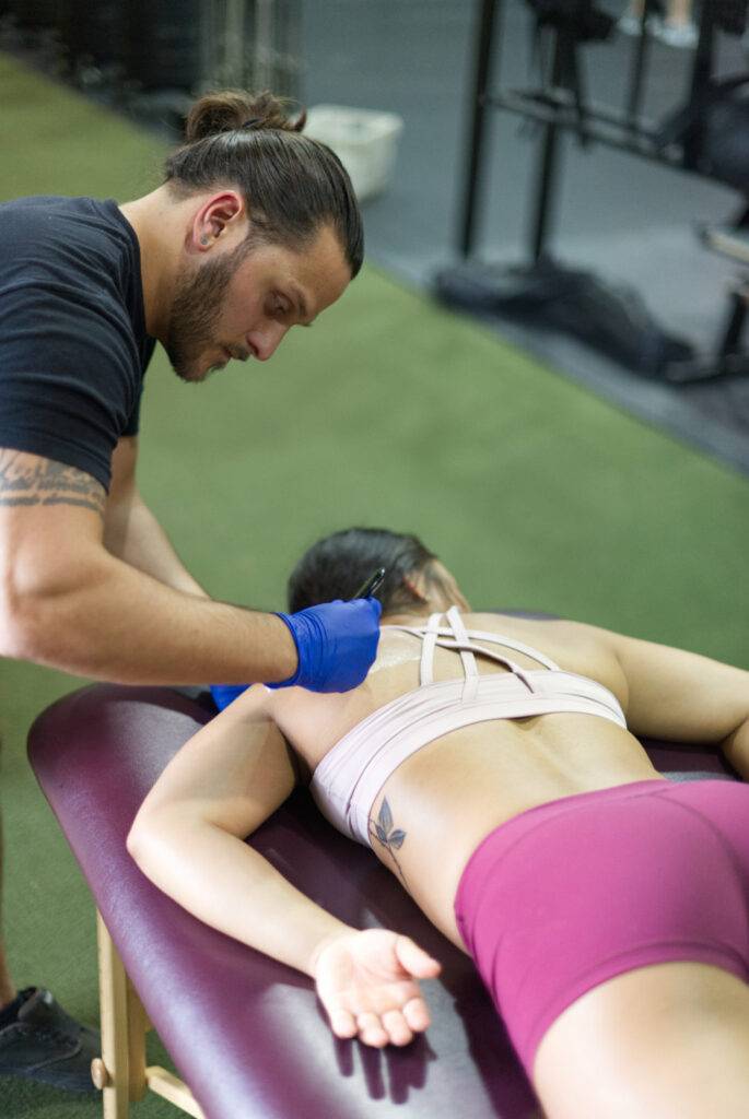 Dr. Rosi Dry Needling an infraspinatus on a female patient